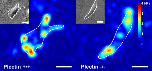 Traction Forces Plectin